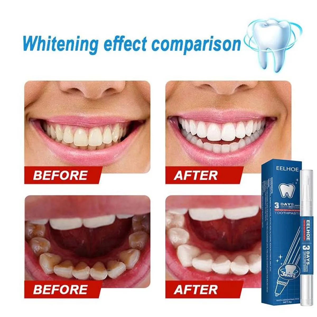 

1Pcs Teeth Whitening Gel Pen Cleaning Remove Plaque Stains Care Tools Tooth Oral Hygiene Natural Tooth Whitening Pen