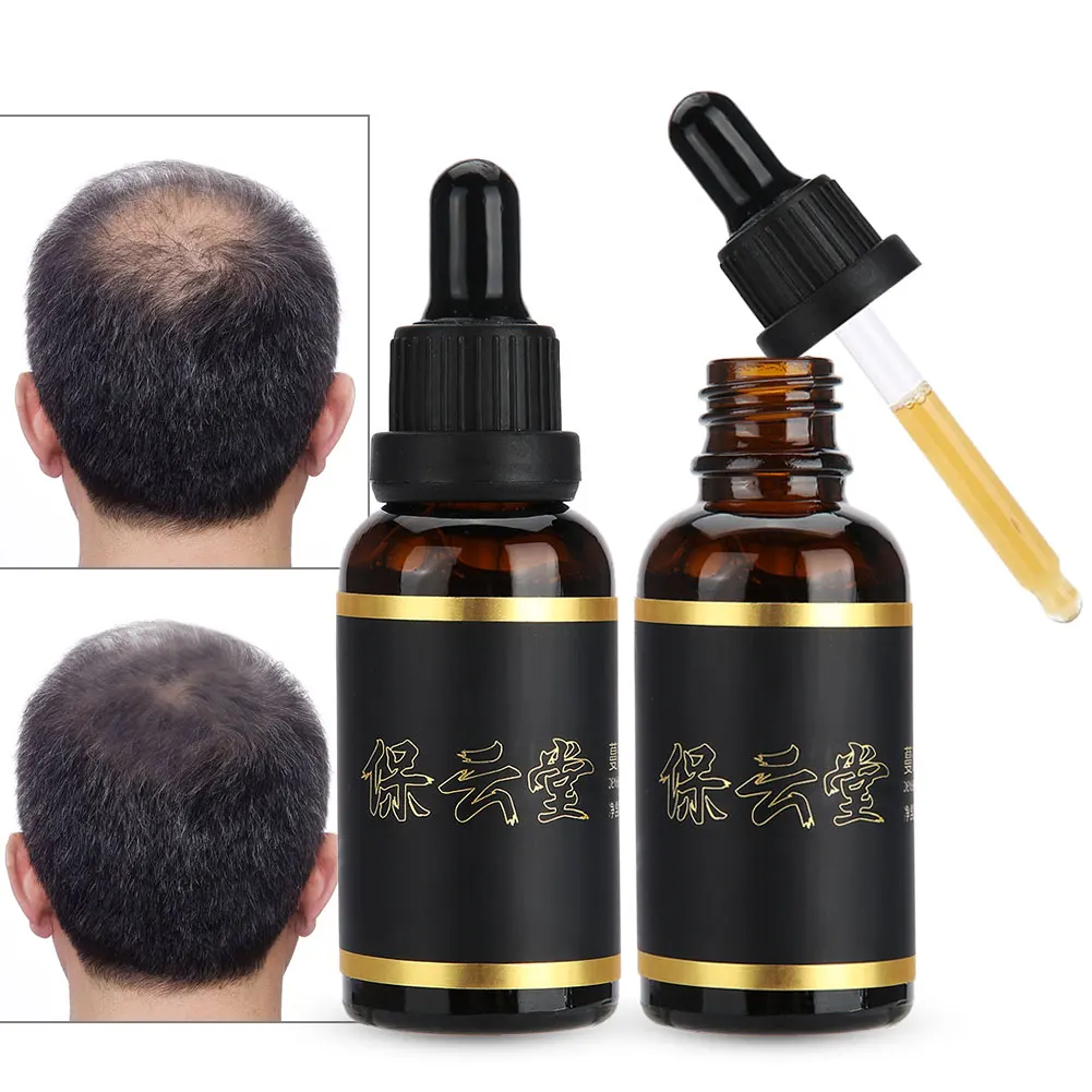30 мл многоцветная Сыворотка для роста волос против выпадения эссенция жидкая