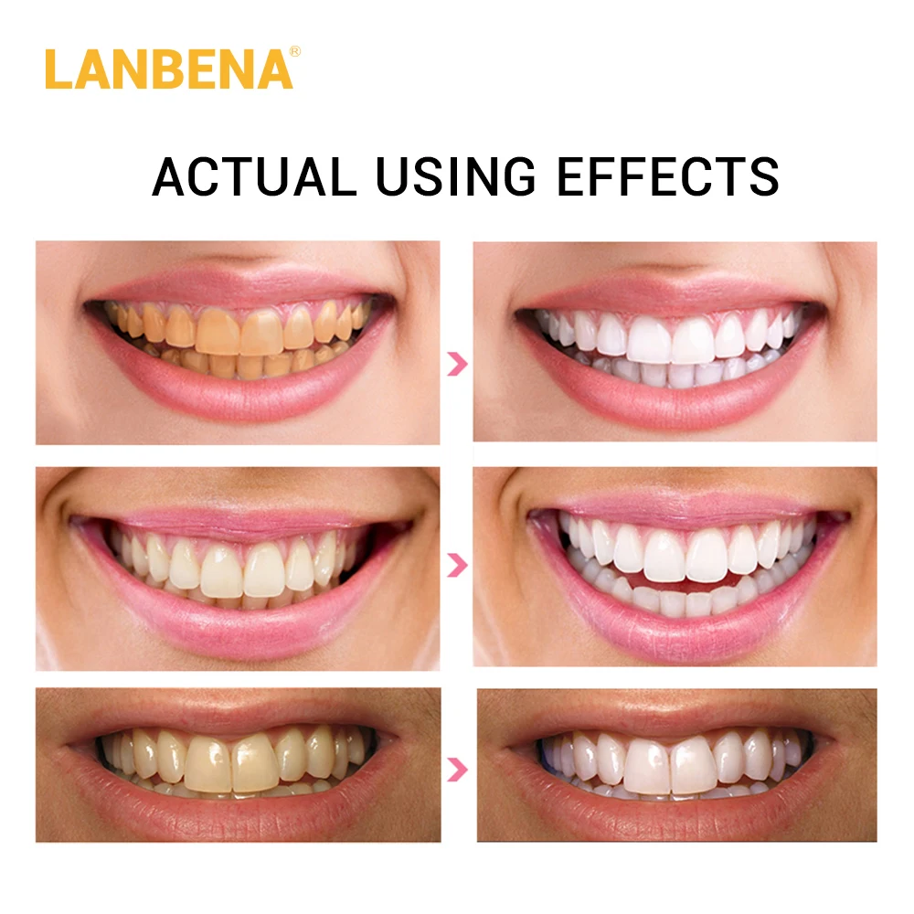 Lanbena отбеливание зубов полоски ежедневное использование + ночная гигиена полости