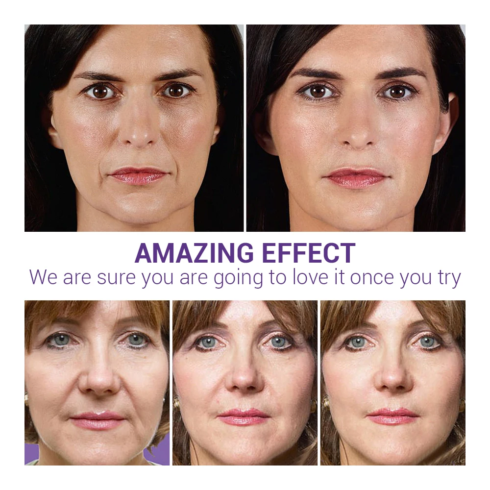LANBENA Blueberry Hyaluronic Acid Serum Whitening Reduces Fine lines Anti-Aging Anti Wrinkle Moisturizing Essence Oil Skin Care | Красота и