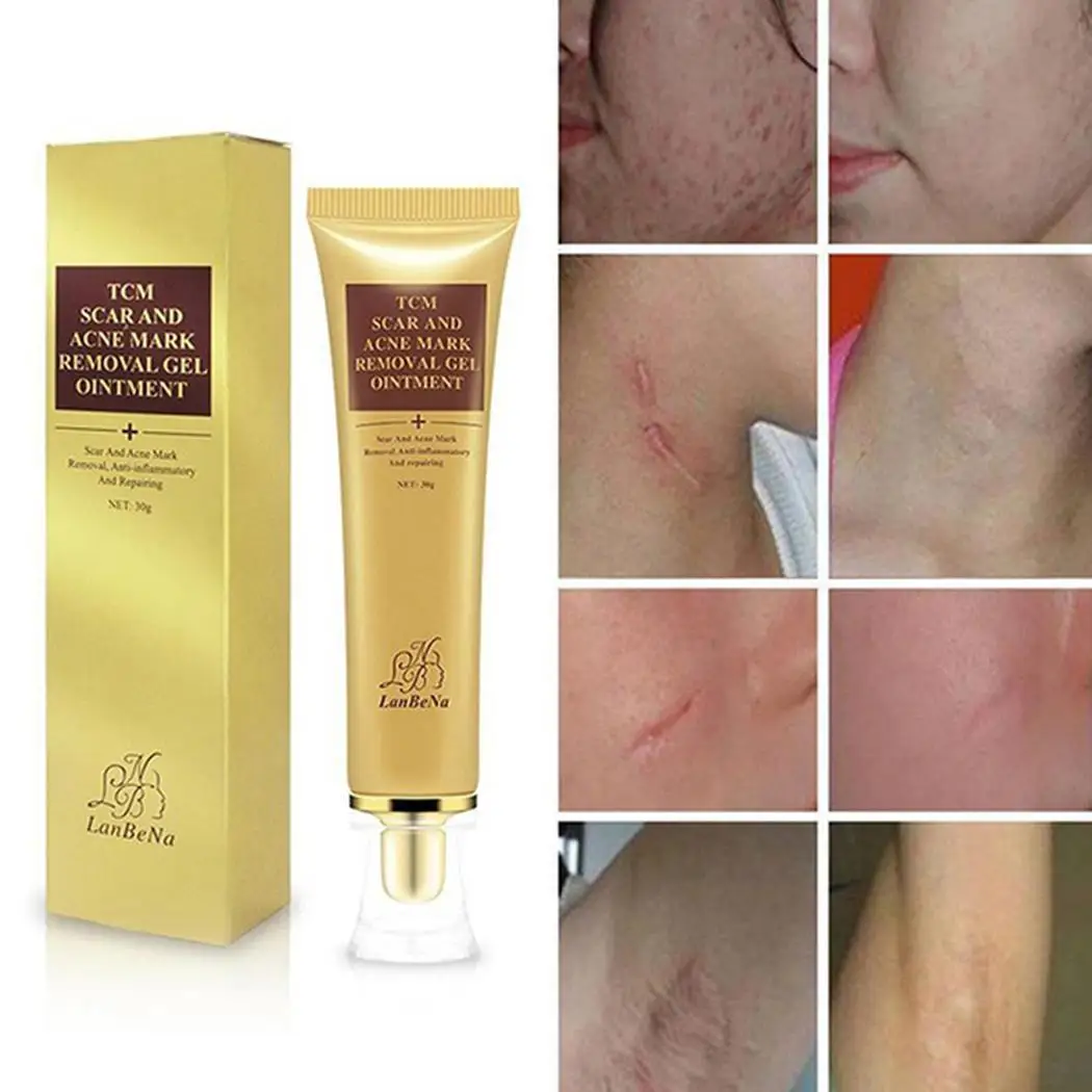 Обычный шрам на изображении Acnes the marks гель новый 30 г ожоги растягивающийся крем