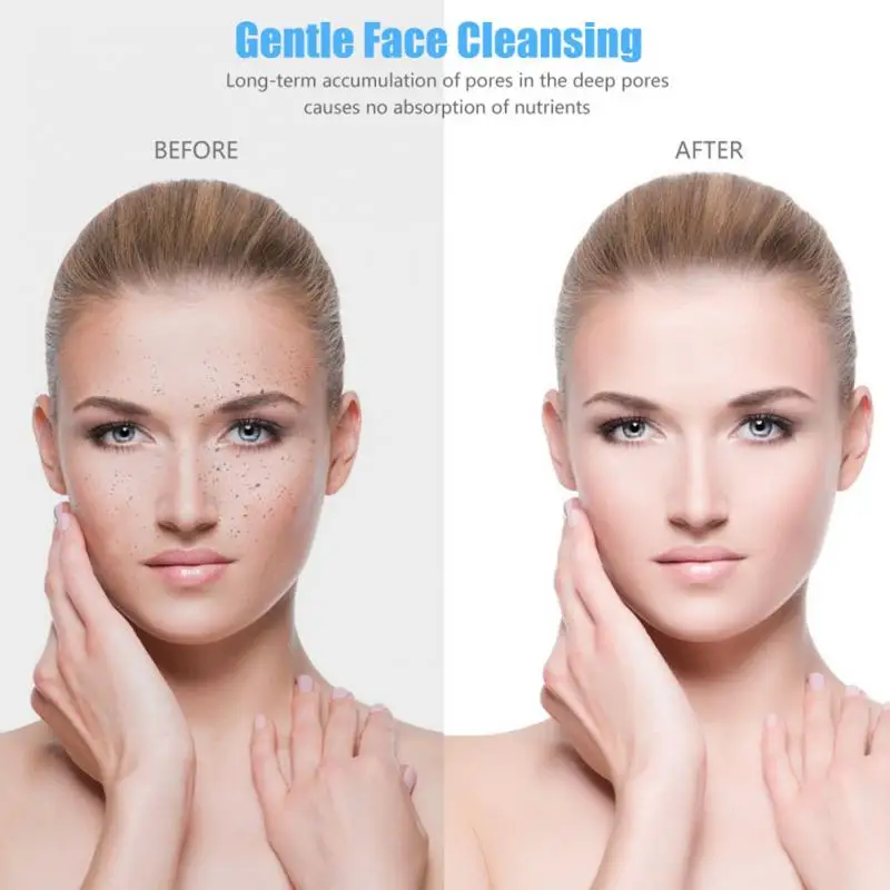 USB анион импортный инструмент для лица косметическая машина ультразвуковая