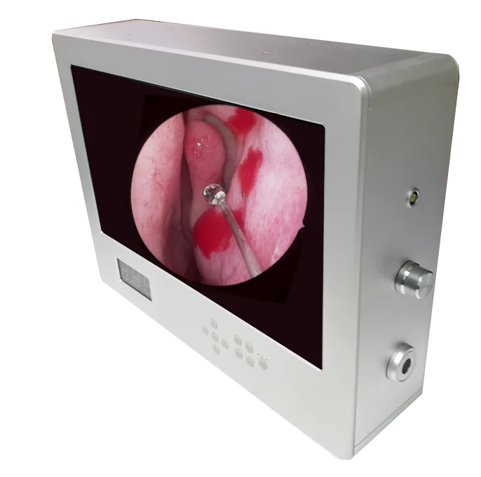 ENT 1920*1080P FULL HD MEDICAL ENDOSCOPE CAMERA SYSTEM Portable Integrated camera system |
