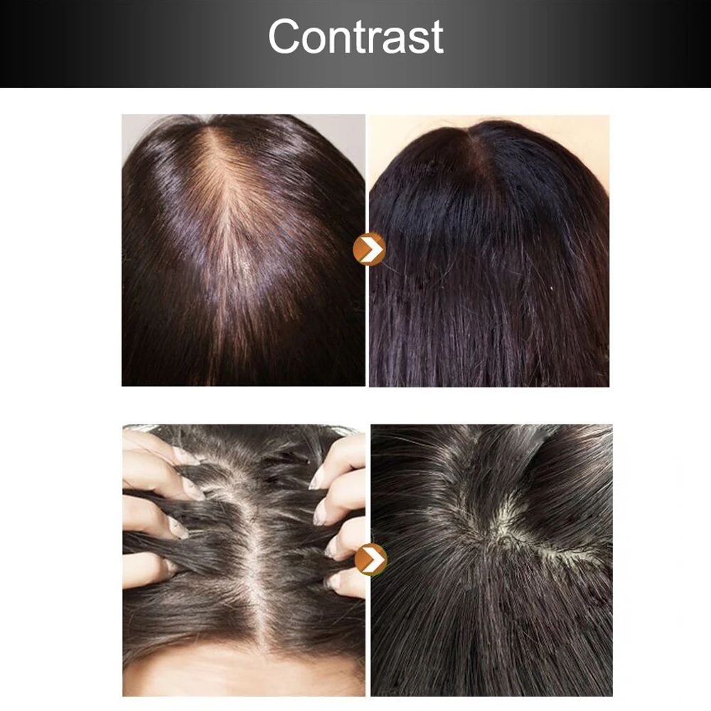 

2pcs/set Hair Growth Essence Professional Hair Growth Fluid Hair Fast Sunburst Hair Growth Product Restoration Pilatory