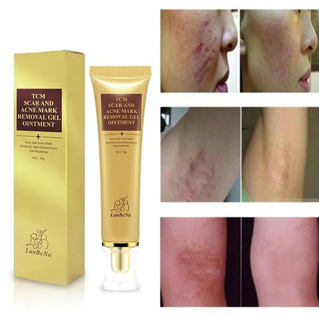 Обычный шрам на изображении Acnes the marks гель новый 30 г ожоги растягивающийся крем
