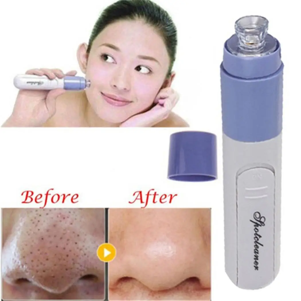 Новый Электрический Очиститель пор Blackhead пылесос инструмент для удаления черных