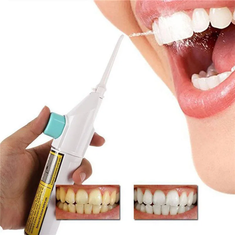 Rakado Portable Dental Floss Cordless Oral Irrigator Water Flosser Power Jet Teeth Cleaning Mouth Denture Clean Tooth Tools | Красота и