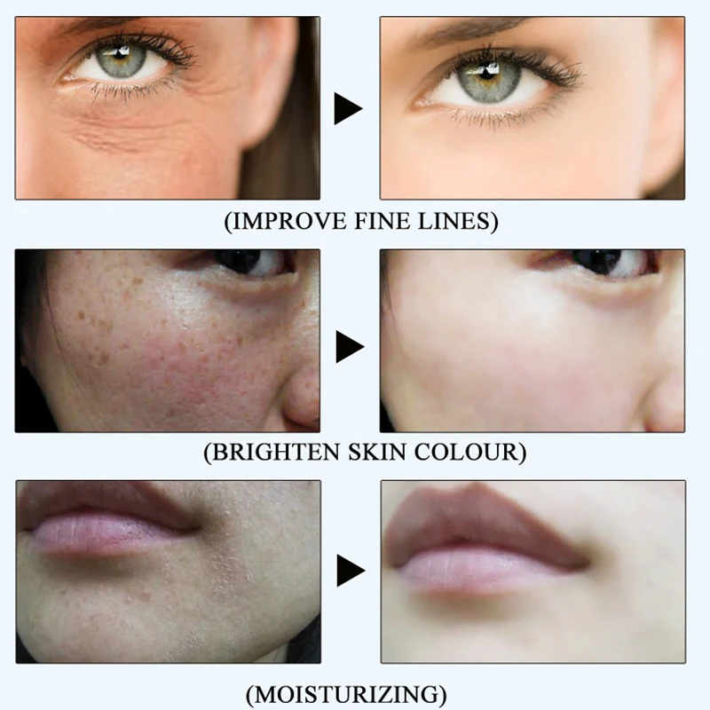 Игла для лица эссенция увлажняющий против морщин Антивозрастной уход за кожей |