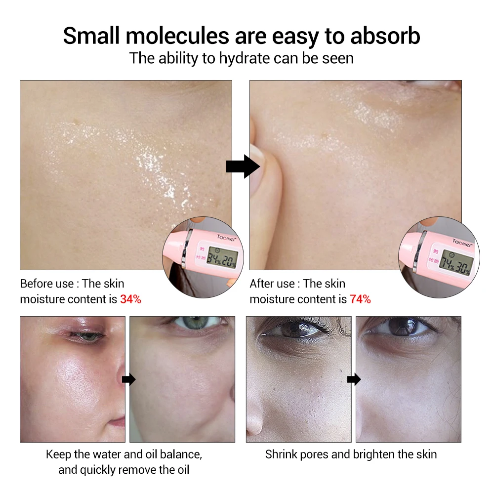 

4 PCS LANBENA Hyaluronic Acid Serum Snail Essence Face Cream Moisturizing Acne Treatment Repair Whitening Anti-Aning Winkles