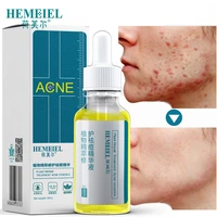 hemeiel acne removal serum lighten acne marks scar plants facial essence repair acne moisturizing whitening korean skin care