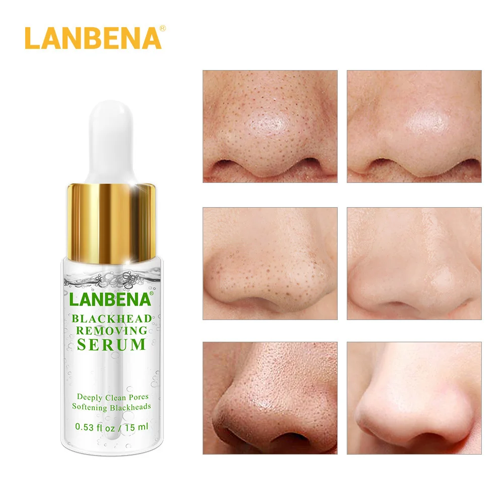 Сыворотка для удаления черных точек LANBENA глубокая поры акне-прыщей бережное