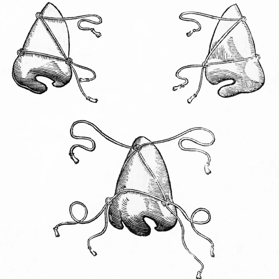 Tagliacozzi's Post Operative Nose Masks 1500 s постер печать наукой Source (18x24)|Таблички и знаки| |