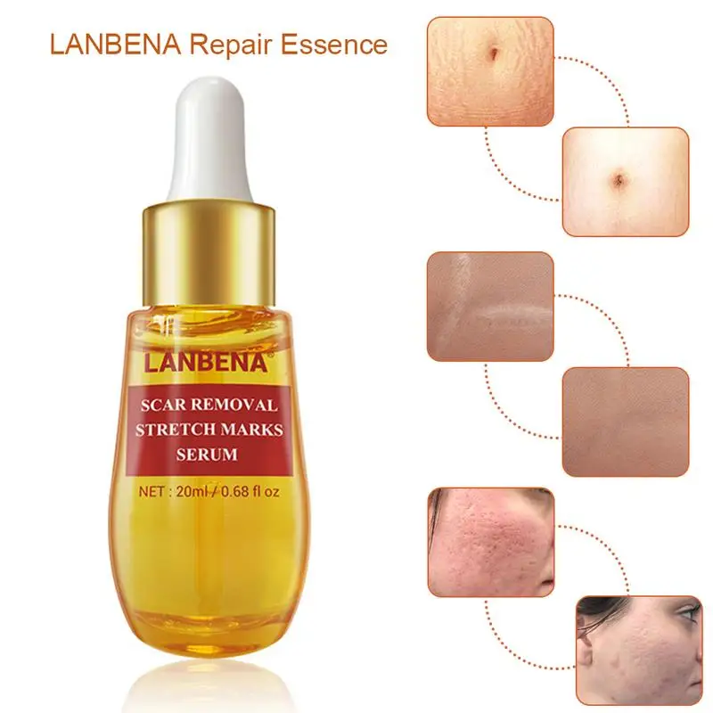 

Средство для удаления черных точек, растяжек и сужения пор