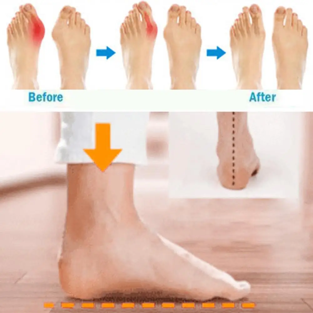 Women PU Leather Comfortable Shoes Flat Sole Ladies Casual Soft Big Toe Foot Correction Orthopedic Sandalwood Valgus Corrector | Спорт и