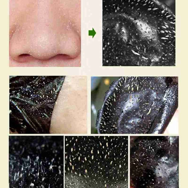 Value Pack Deep очиститель угрей удаление кожи Очищающая маска для лица| |