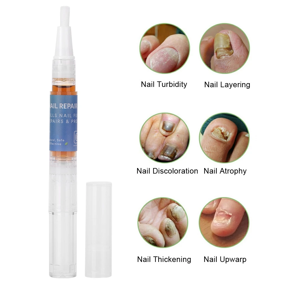 3 мл Лечение грибка для ногтей жидкий онихомикоз ремонт жидкость анти грибковый