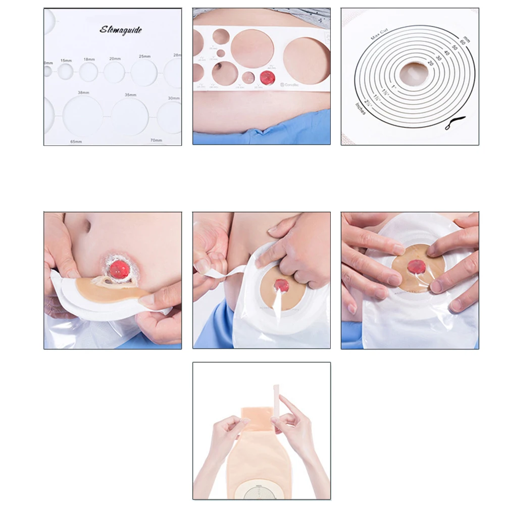 10 шт. закрытые одноразовые пакеты для слива Ostomy Colostomy Stoma Care Ileostomy|Товары женской