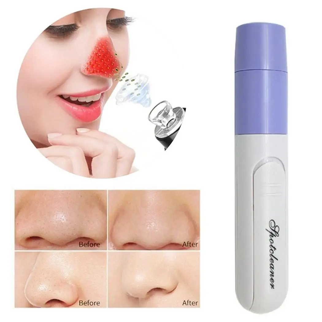 Новый Электрический Очиститель пор Blackhead пылесос инструмент для удаления черных