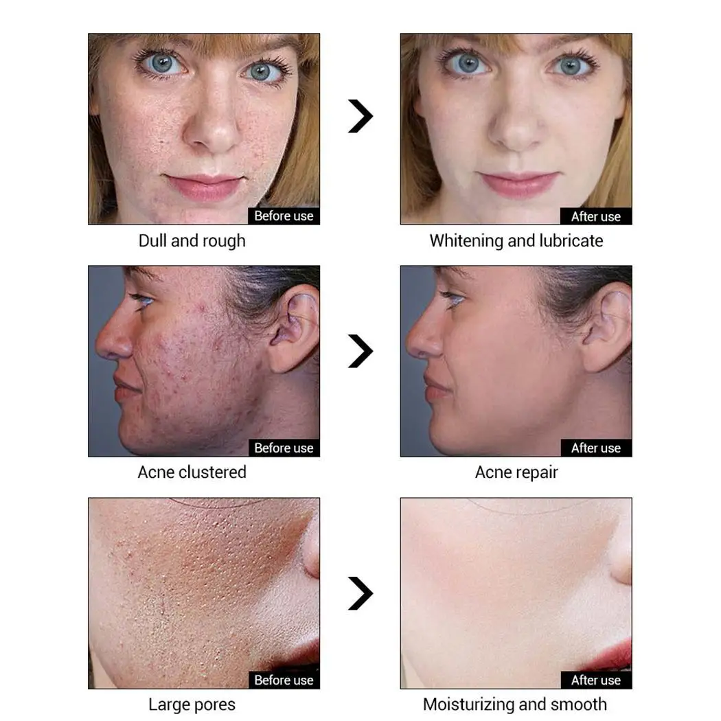 Salon Face Fashion Pores Facial Anti etc Wrinkle Skin 30g Home All Whitening Cream Shrink Type | Красота и здоровье