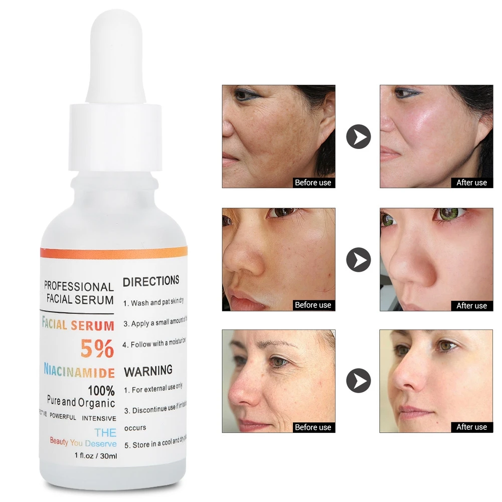 Профессиональная Сыворотка для лица Niacinamide отбеливающая укрепляющая сыворотка