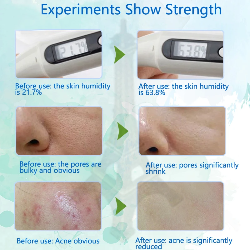 100g Natural Aloe Vera Gel Moisturizing Soothing Nourish Cream Face Skin Care * | Scrubs &amp Bodys Treatments