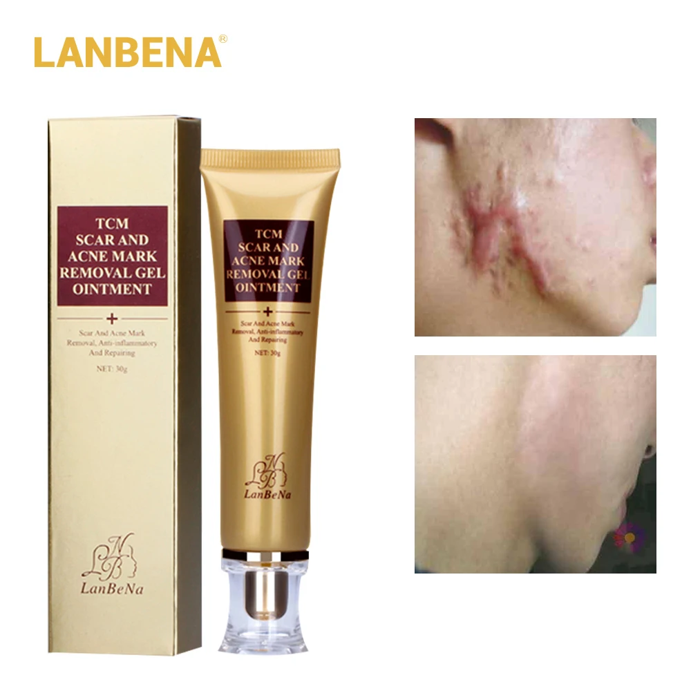 Купить 3 получить 1 подарок Lanbena Egf крем для удаления шрамов растягивающийся знак