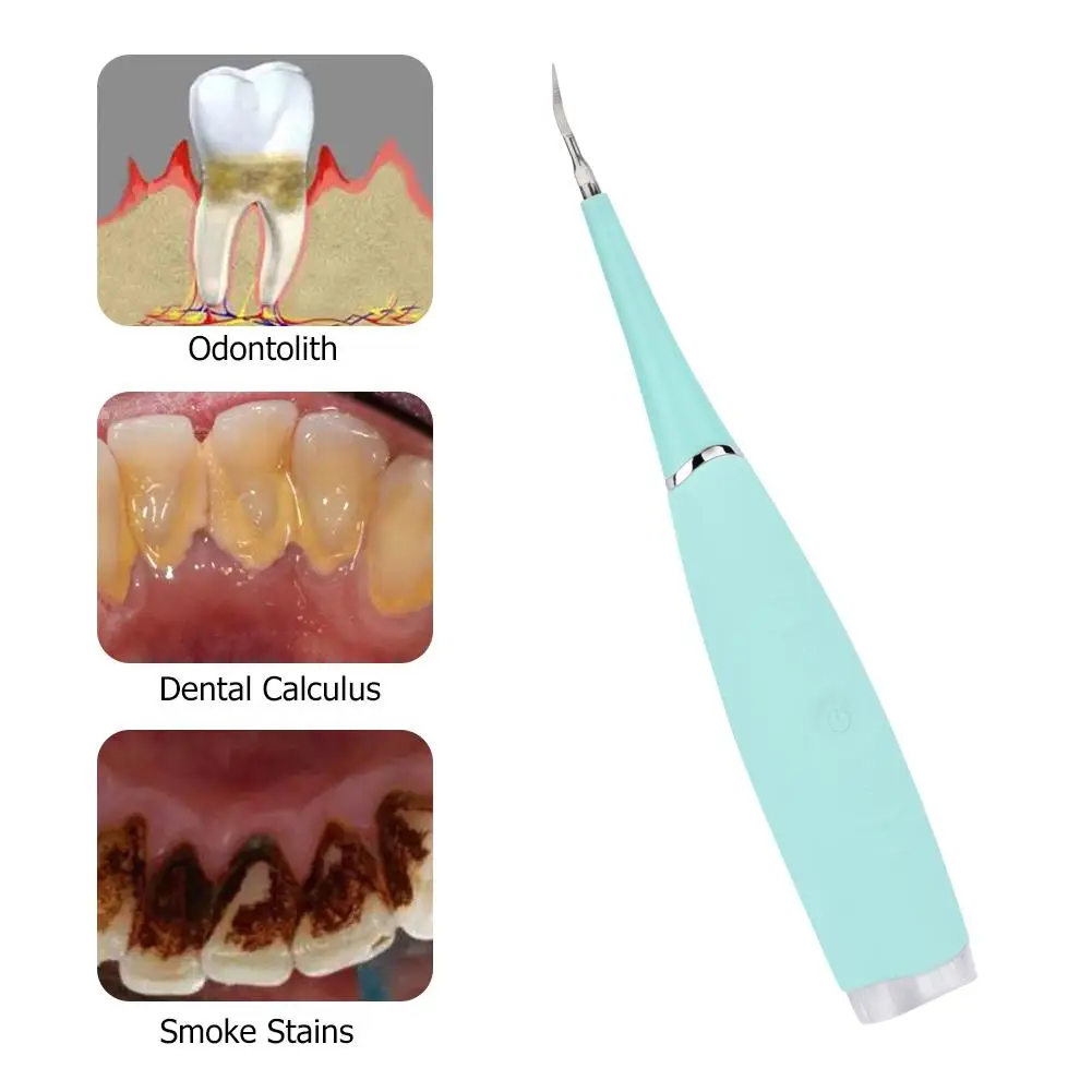 XY Fancy Waterproof Dental Cleansing Machine Teeth Whitening Tooth Stain Eraser Tartar Stains Remove Tools USB Charging | Красота и