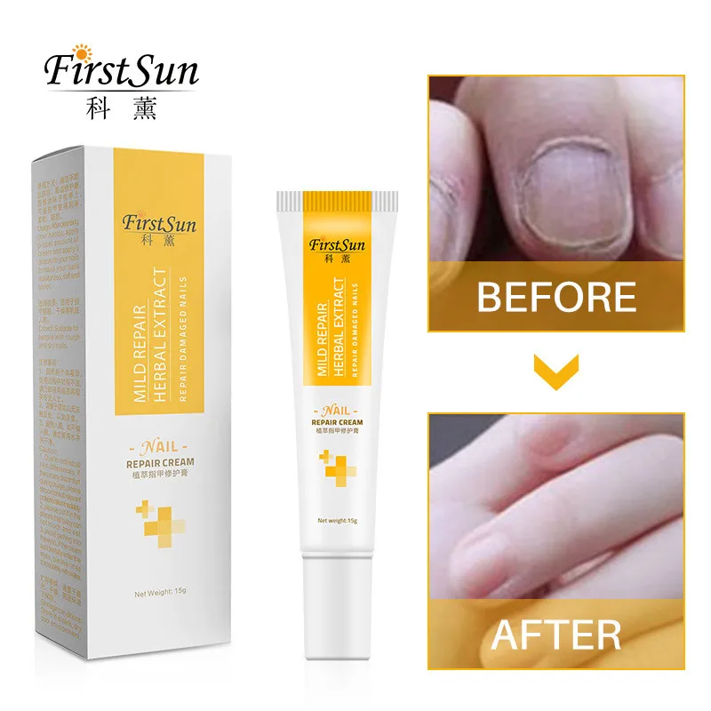 Жидкий мягкий восстанавливающий крем Firstsun для ногтей 15 г лечения грибка уход за