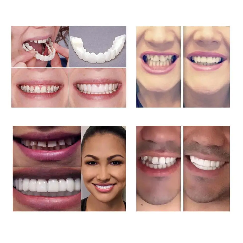 Sangdo Teeth Whitening Cover Perfect Smile Comfort Fit Flex Veneers Upper + Lower Set | Украшения и аксессуары