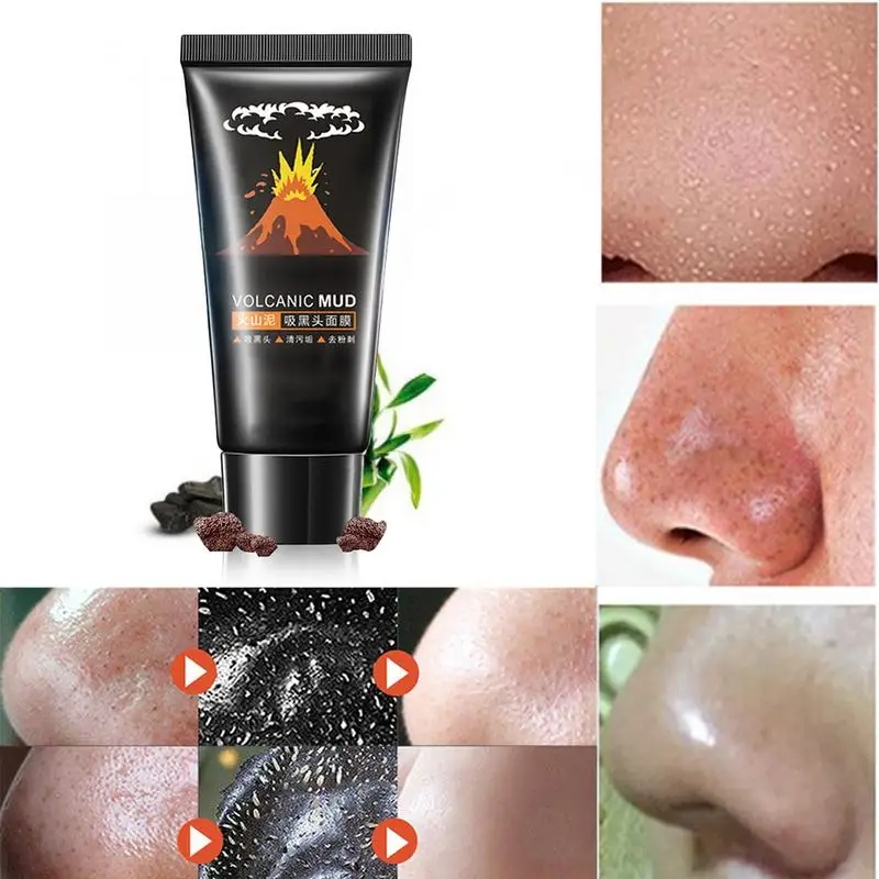 Мужская и женская грязевая маска для удаления угрей лица удаление акне Очищающая