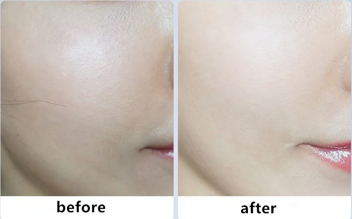Face Whitening Cream For Dark Skin Spots Scars Snow White Day Night Korean Care 30g |