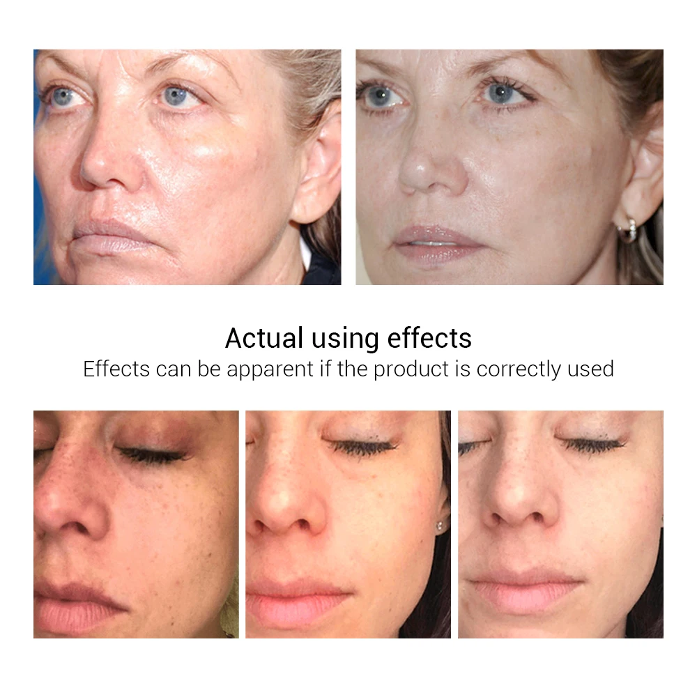 LANBENA Гиалуроновая кислота ремонт увлажняющий эфирное масло кожи Сыворотки уход