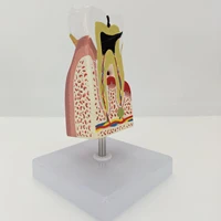 human diseased teeth anatomical model medical anatomy for patient education teaching resources
