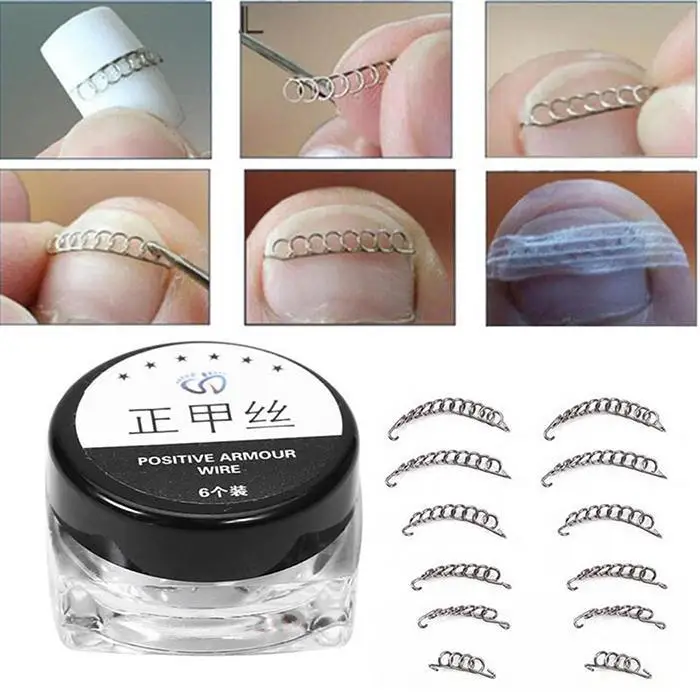 12pcs Professional Toe Nail Correction Wire Fixer Pedicure Paronychia Recover Toenails Corrector Foot Care Tool | Красота и здоровье