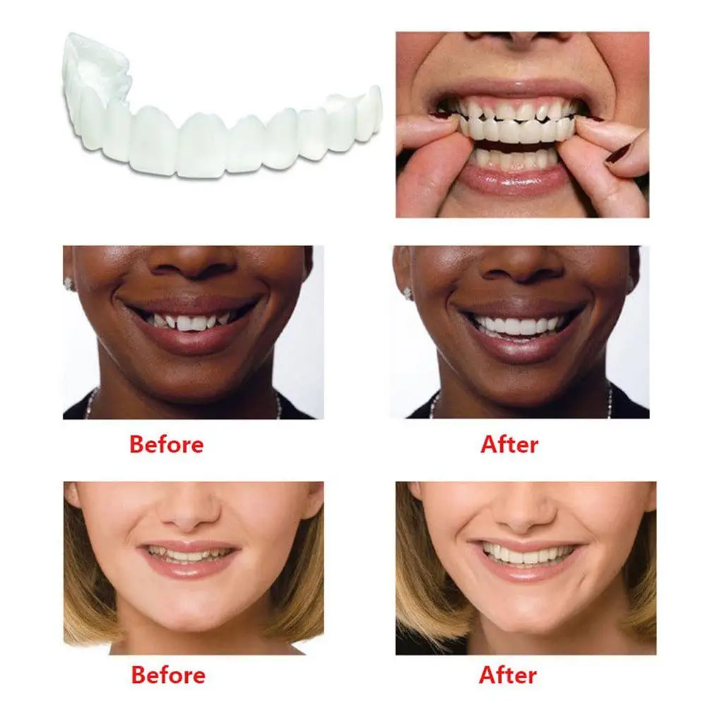 Sangdo Teeth Whitening Cover Perfect Smile Comfort Fit Flex Veneers Upper + Lower Set | Украшения и аксессуары