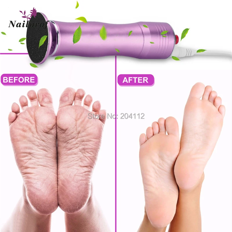 Nailprof Электрический педикюр инструменты Уход за ногами инструмент машина мозолей