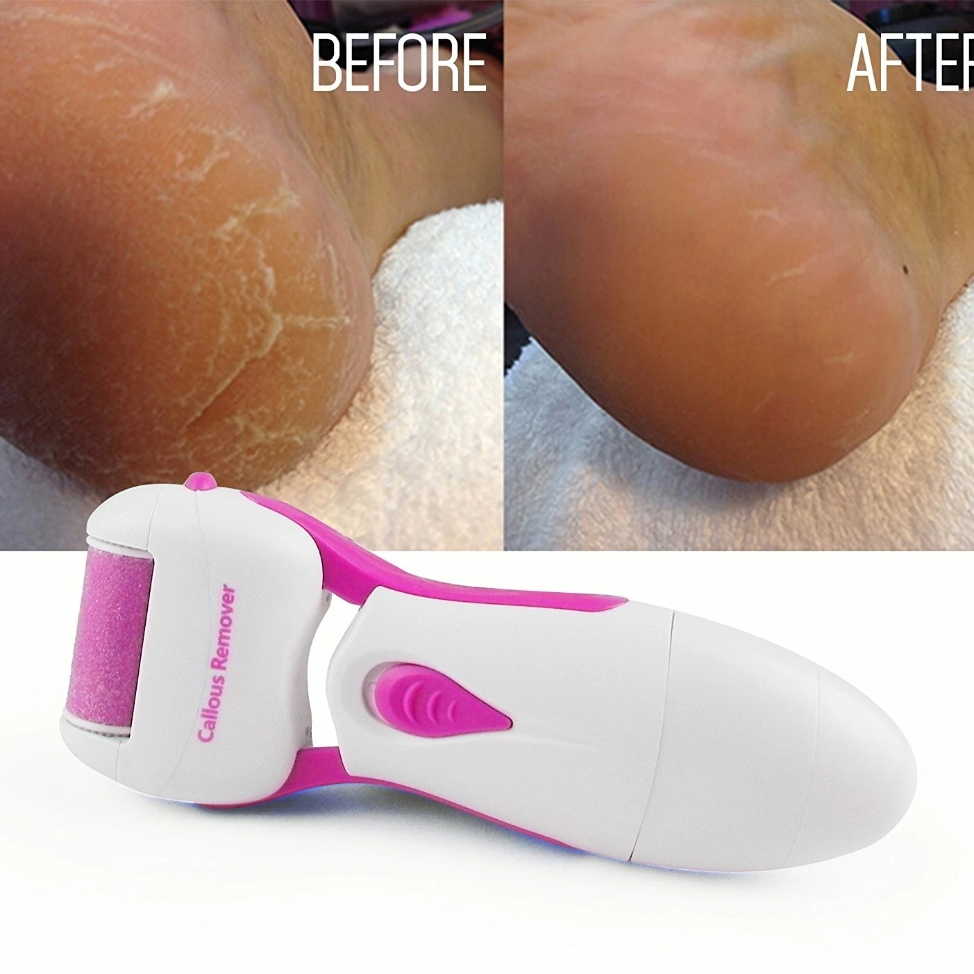 Инновационная батарея Powered Personal Pedi инструмент для пилинга ног удаление