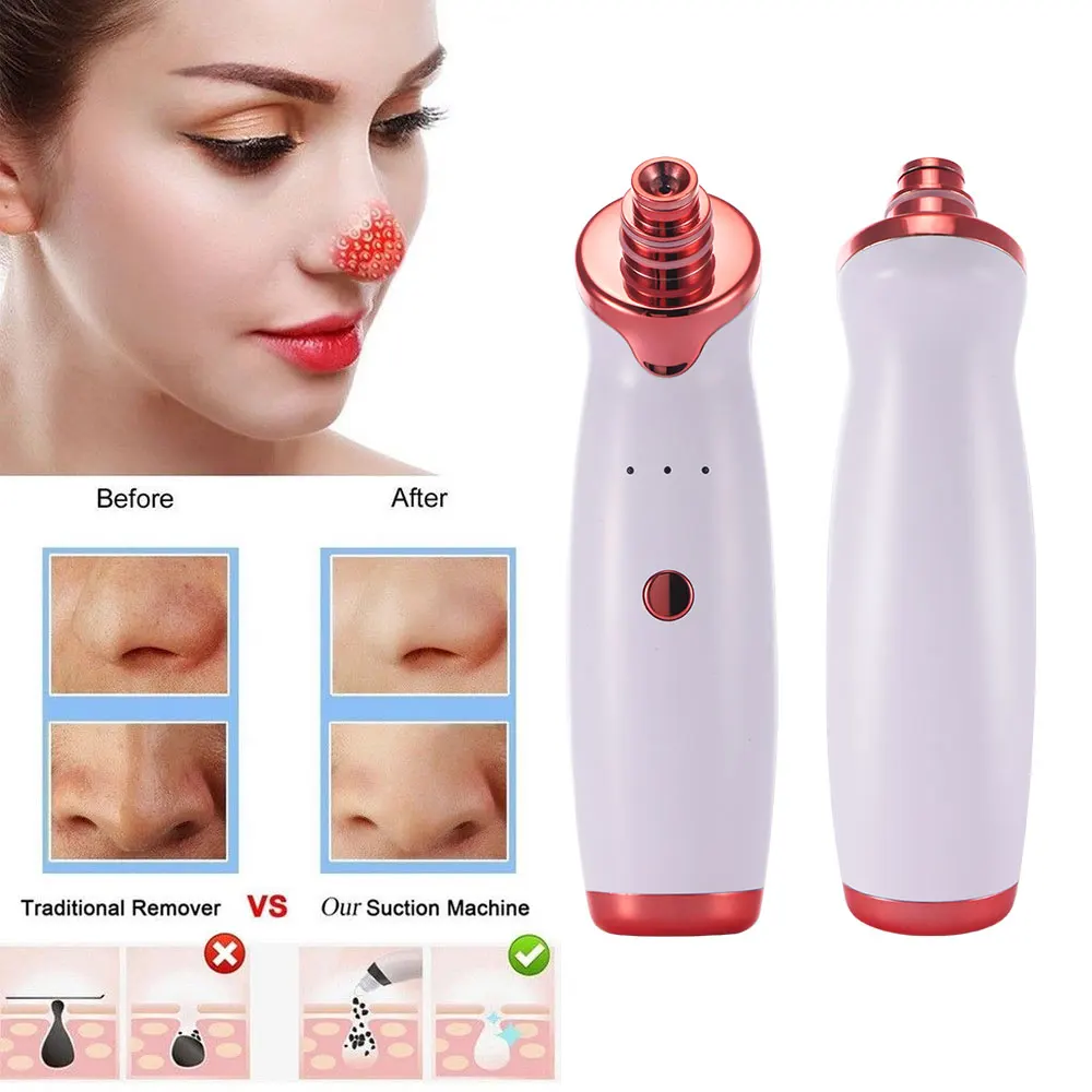 USB Перезаряжаемый Электрический очиститель кожи от акне удаление грязи и угрей