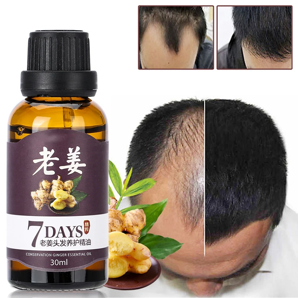 30ml Unisex Fast Hair Growth Essence Anti Loss Treatment Nourishing Natural Plant Extract Tool | Красота и здоровье