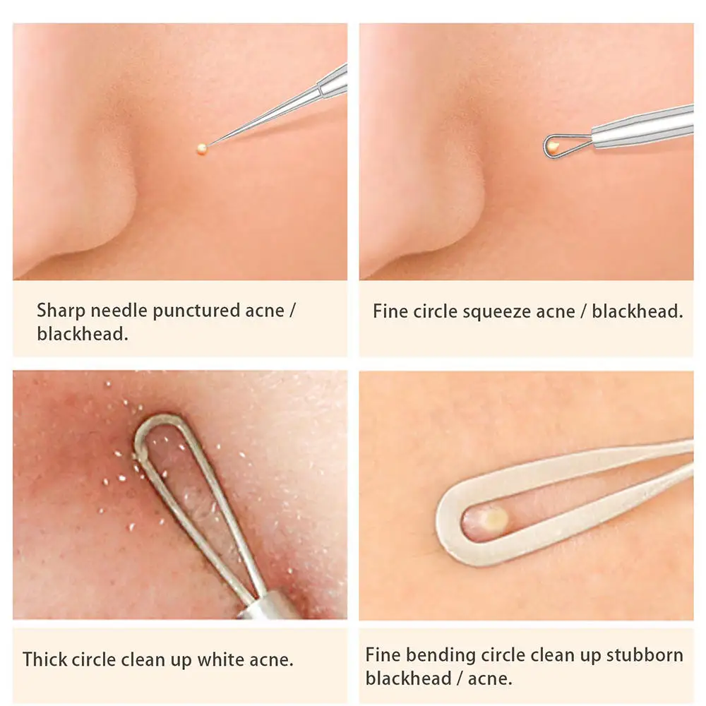 

5pcs/Set Blackhead Remover Acne Blackhead Vacuum Comedone Belmish Extractor Pimple Remover Tool Spoon For Face