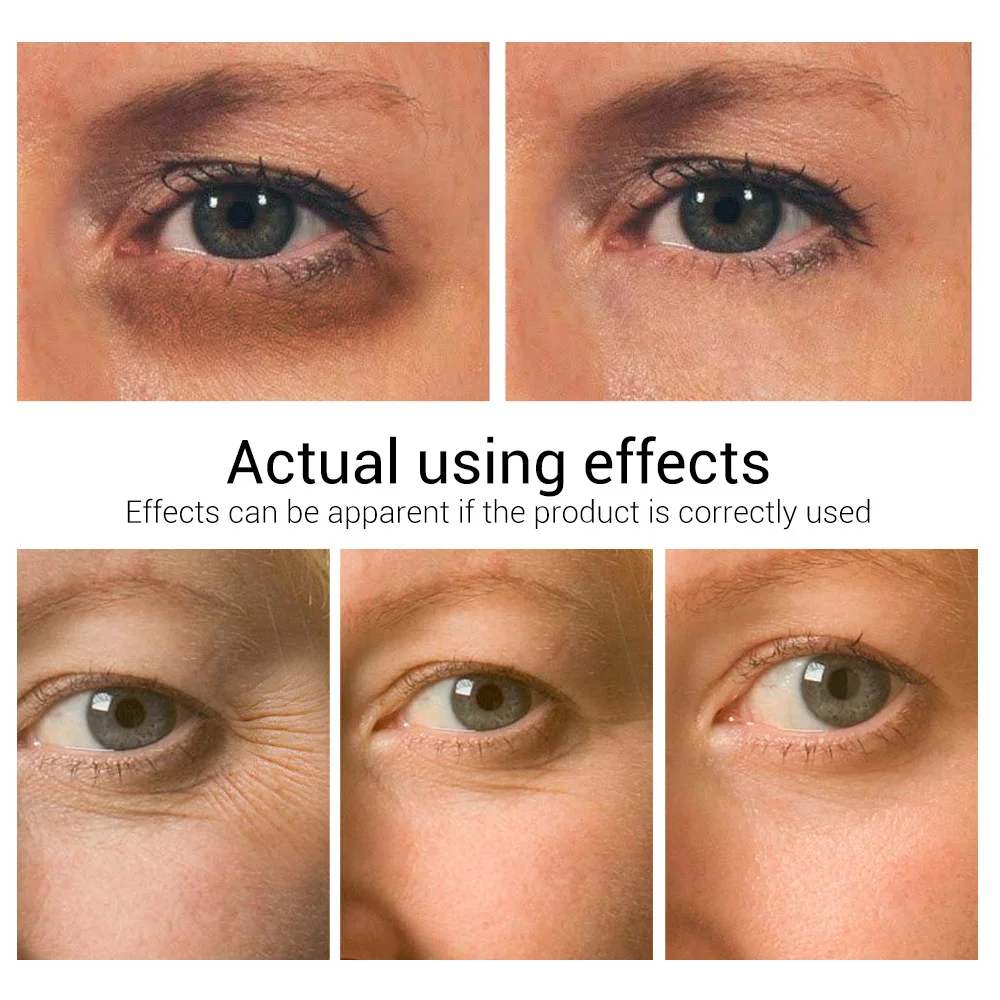 Отбеливающий крем для кожи вокруг глаз от Тёмных кругов и мешков| |