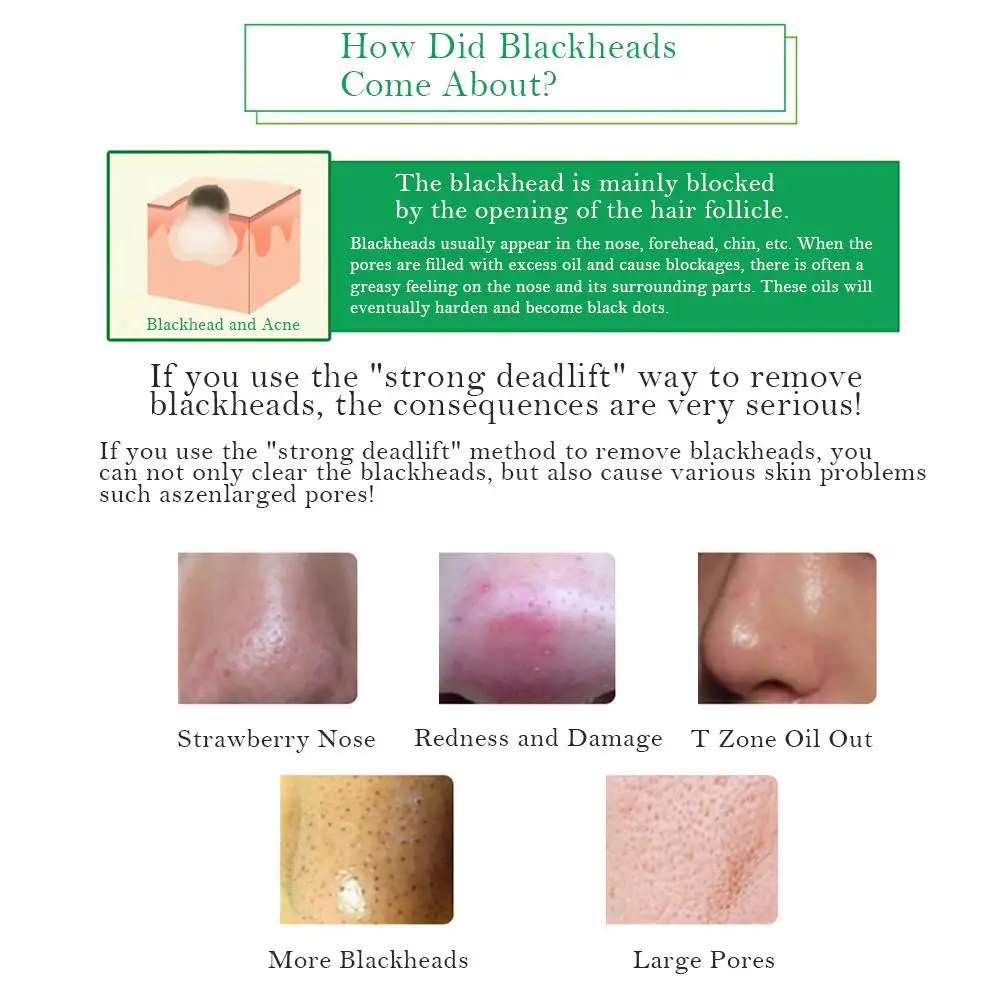 Blackhead Export Essence-для BEACUIR смягчающий кератин поплавок черные точки усадка набор t zone уход