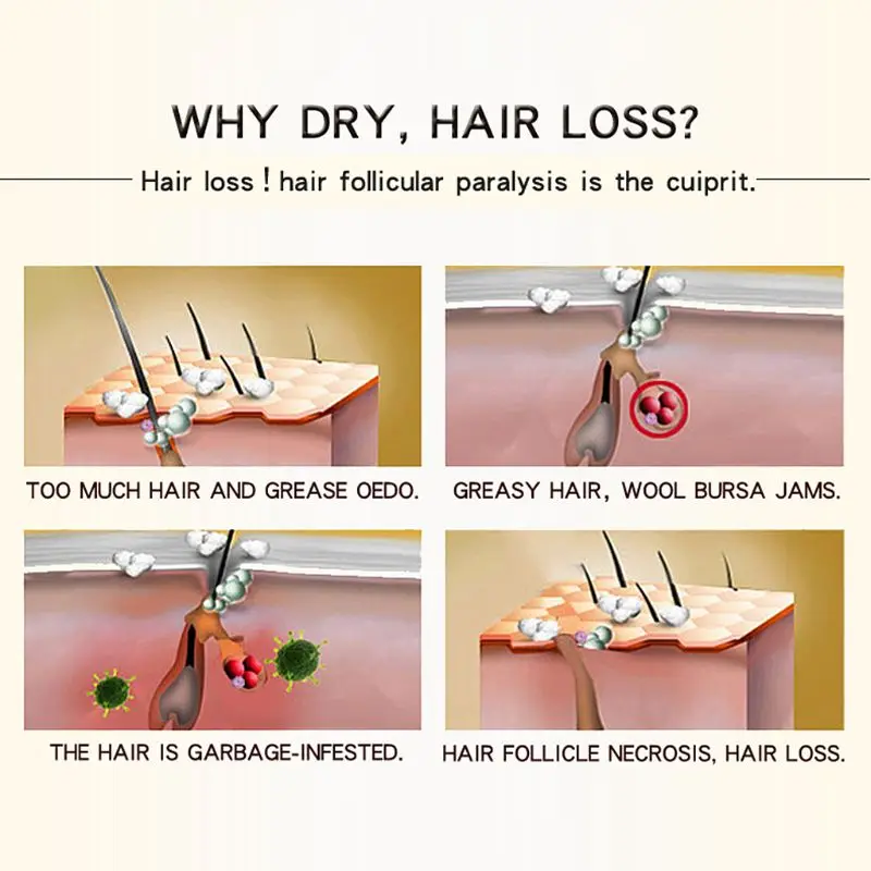 1 шт. марокканский травяной женьшень для ухода за волосами эссенция мужчин и