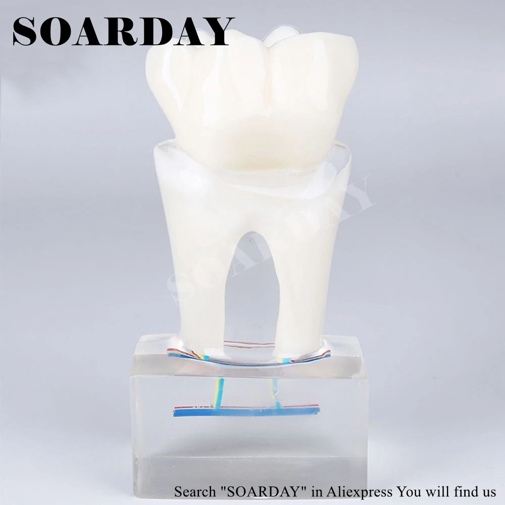 SOARDAY шестикратная модель анатомии зубного нерва патологическая