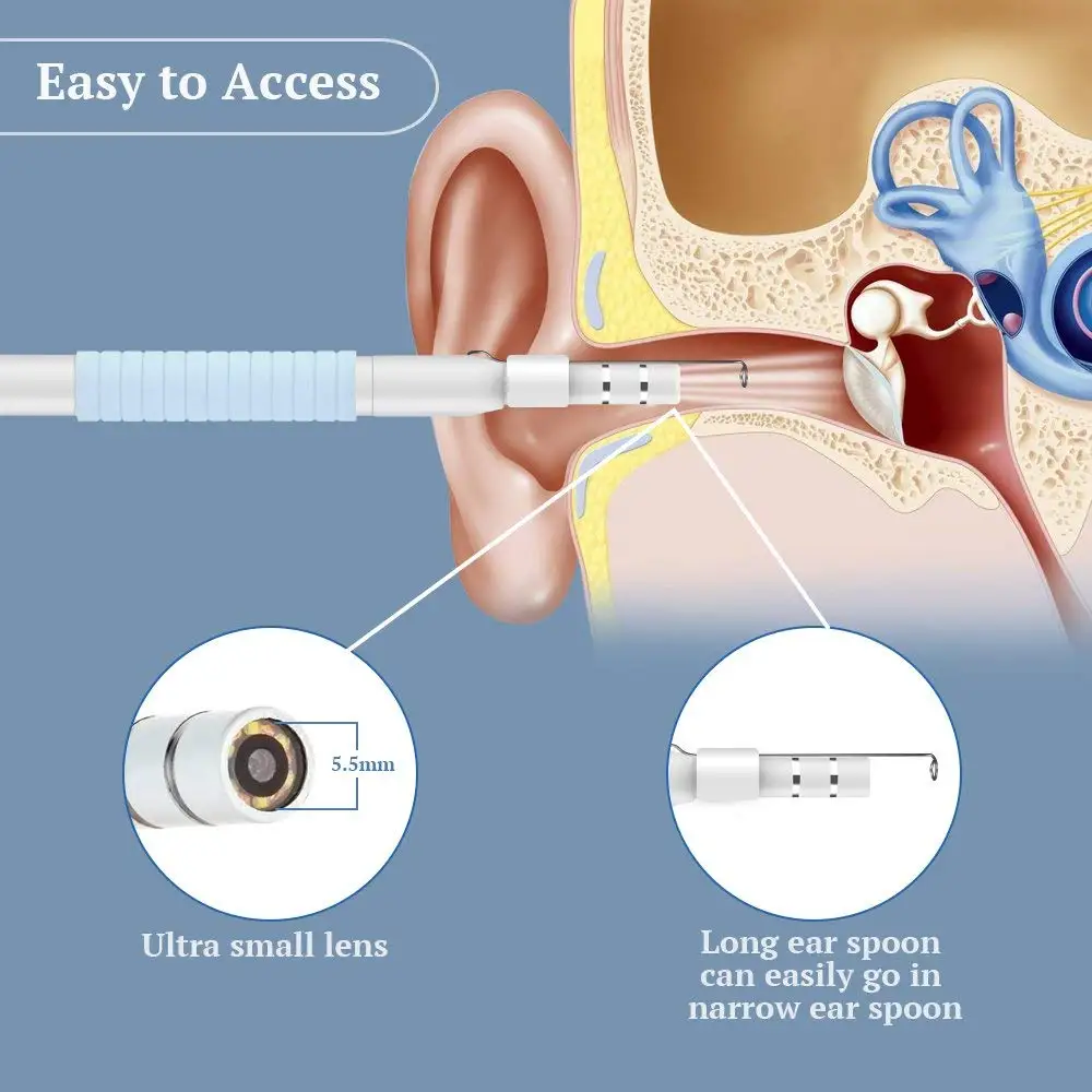 1.3MP 3 In 1 USB OTG Visual Ear Cleaning Endoscope Spoon Functional Diagnostic Tool Cleaner Android 720P Camera Pick | Электроника