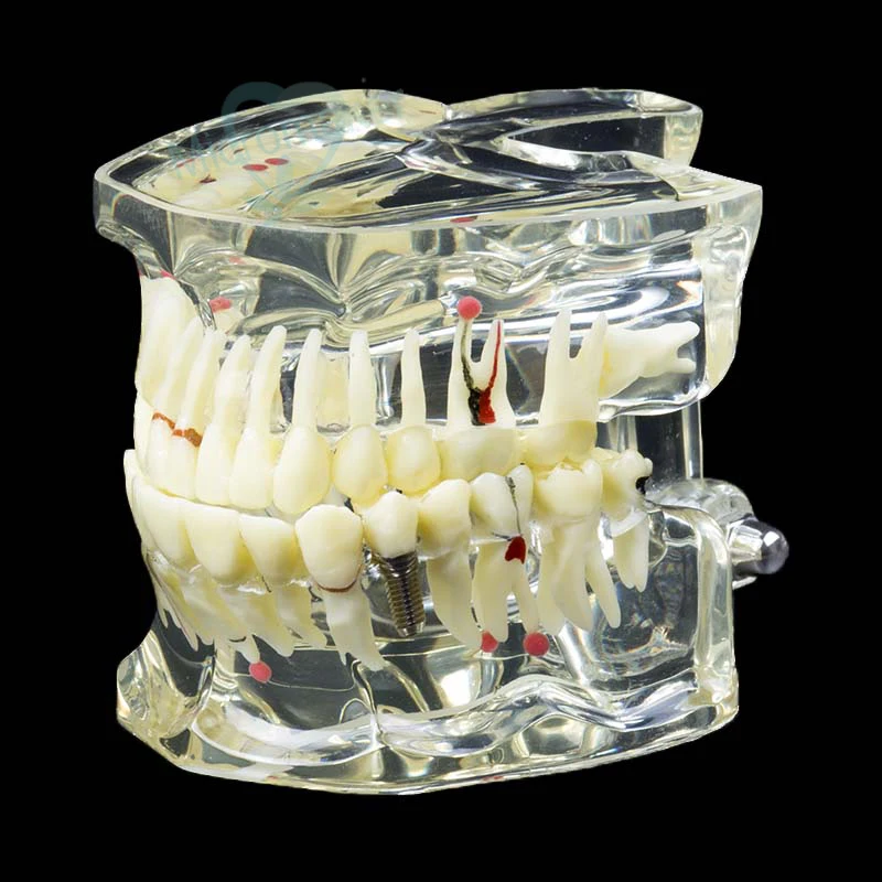 1 шт. Стоматологическая Ортодонтическая Исследование Научите зубы модель с