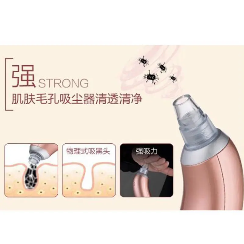 Для лица пор Пылесосы для автомобиля кожи пилинг Акне Прыщ удаление акне