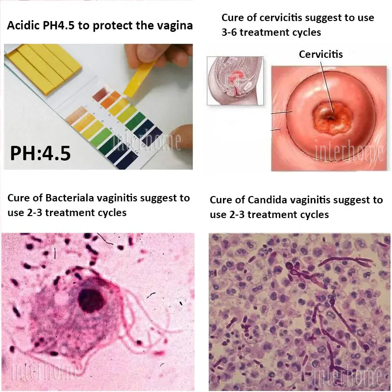 Гинекологический гель Антибактериальный для подтяжки женского влагалища|Товары