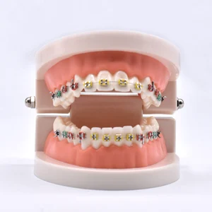 Стоматологическая модель ортодонтической терапии с Орто-металлическим керамическим кронштейном, дуговая проволока, зубная трубка, лигатурные стяжки