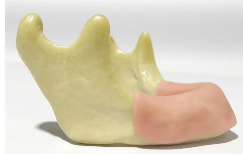 Бионическая челюсть десневые зубы реставрация полости рта практическое